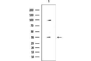 Western blot analysis of lysates from HUVEC cells, using ZNF771 Antibody at 1/1000 dilution.