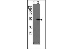 Western blot analysis of YBX1(arrow) using rabbit polyclonal YBX1 Antibody (YBX1 抗体  (C-Term))