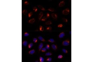 Immunofluorescence analysis of U-2 OS cells using TXNDC12 Polyclonal Antibody (ABIN7270800) at dilution of 1:100 (40x lens). (TXNDC12 抗体  (AA 93-172))