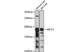 Western blot analysis of extracts of various cell lines, using  antibody (ABIN6134206, ABIN6136365, ABIN6136366 and ABIN6224126) at 1:1000 dilution. (ABCC6 抗体  (AA 830-940))