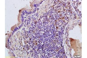 Formalin-fixed and paraffin embedded rat lung labeled with Anti-RHEB Polyclonal Antibody, Unconjugated (ABIN704771) at 1:200 followed by conjugation to the secondary antibody and DAB staining. (RHEB 抗体  (AA 101-184))