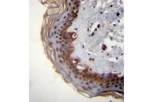 Formalin fixed, paraffin embedded human skin tissue stained with RBM42 Antibody (C-term) followed by peroxidase conjugation of the secondary antibody and DAB staining. (RBM42 抗体  (C-Term))