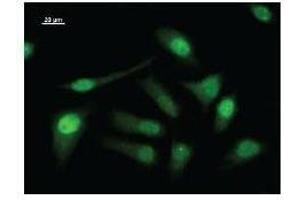 Immunostaining analysis in HeLa cells. (LSM10 抗体)