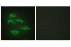 Immunofluorescence analysis of HepG2 cells, using SERC3 antibody. (SERINC3 抗体  (C-Term))