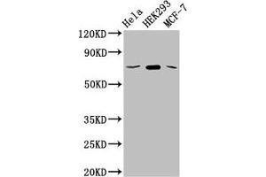 Western Blotting (WB) image for anti-Solute Carrier Family 2 (Facilitated Glucose Transporter), Member 1 (SLC2A1) (AA 263-458) antibody (ABIN7170002)