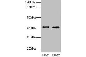 Western blot All lanes: FOXR2 antibody at 4 μg/mL Lane 1: SH-SY5Y whole cell lysate Lane 2: Hela whole cell lysate Secondary Goat polyclonal to rabbit IgG at 1/10000 dilution Predicted band size: 36 kDa Observed band size: 36 kDa (FOXR2 抗体  (AA 1-300))