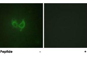 Immunofluorescence analysis of HUVEC cells, using MARK2 polyclonal antibody . (MARK2 抗体)