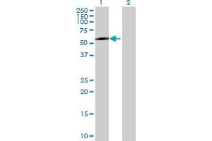 Western Blot analysis of MAGEC2 expression in transfected 293T cell line by MAGEC2 MaxPab polyclonal antibody. (MAGEC2 抗体  (AA 1-373))