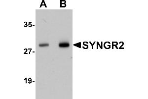 Western Blotting (WB) image for anti-Synaptogyrin 2 (SYNGR2) (N-Term) antibody (ABIN1031591) (SYNGR2 抗体  (N-Term))