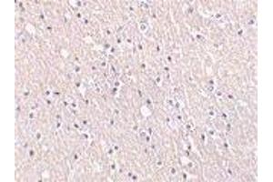 Immunohistochemical staining of CIDE-A in human brain tissue with CIDE-A antibody at 5μg/ml. (CIDEA 抗体  (AA 200-217))