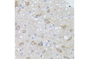 Immunohistochemistry of paraffin-embedded rat brain using  antibody (ABIN6129179, ABIN6136708, ABIN6136710 and ABIN6222176) at dilution of 1:100 (40x lens). (AKAP5 抗体  (AA 1-270))