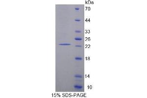 SDS-PAGE analysis of Human EIF2C1 Protein. (AGO1 蛋白)