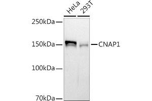 Western blot analysis of extracts of various cell lines, using (ABIN7268948) at 1:1000 dilution. (NCAPD2 抗体)
