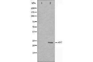 Western blot analysis on HeLa cell lysate using ARC Antibody,The lane on the left is treated with the antigen-specific peptide. (NOL3 抗体  (C-Term))