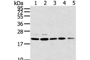 Western Blot analysis of 293T, 231, PC3, A549 and K562 cell using TPD52L1 Polyclonal Antibody at dilution of 1:300 (TPD52L1 抗体)
