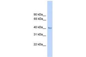 Image no. 1 for anti-Aminolevulinate Dehydratase (ALAD) (N-Term) antibody (ABIN6745534) (ALAD 抗体  (N-Term))