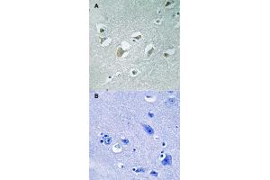Immunohistochemical staining of human brain tissue by MAP3K9/MAP3K10 (phospho T312/266) polyclonal antibody  without blocking peptide (A) or preincubated with blocking peptide (B) under 1:50-1:100 dilution. (MAP3K9 抗体  (pThr266, pThr312))