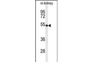 Western blot analysis of PCB Antibody (N-term) (ABIN651181 and ABIN2840115) in mouse kidney tissue lysates (35 μg/lane). (PMPCB 抗体  (N-Term))