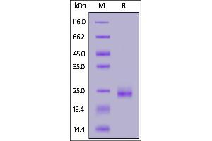 SDS-PAGE (SDS) image for GTPase Kras (KRAS) (AA 1-169) protein (His tag) (ABIN7013192)