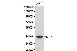 Western Blotting (WB) image for anti-Doublecortin (DCX) (AA 11-360) antibody (ABIN3021510) (Doublecortin 抗体  (AA 11-360))