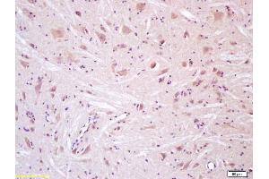 Immunohistochemistry (IHC) image for anti-Transient Receptor Potential Cation Channel, Subfamily V, Member 4 (TRPV4) (AA 301-400) antibody (ABIN873245)