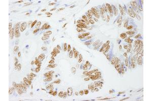 Immunohistochemistry (IHC) image for anti-Splicing Factor Proline/glutamine-Ric (SFPQ) (AA 657-707) antibody (ABIN7449003) (SFPQ 抗体  (AA 657-707))
