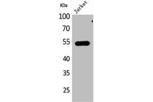 Western Blot analysis of Jurkat cells using DPP7 Polyclonal Antibody (DPP7 抗体  (C-Term))