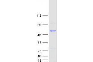 Western Blotting (WB) image for Sorting Nexin 5 (SNX5) (Transcript Variant 1) protein (Myc-DYKDDDDK Tag) (ABIN2732408)