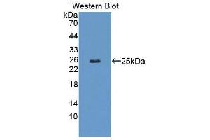 Detection of Recombinant LAMb2, Mouse using Polyclonal Antibody to Laminin Beta 2 (LAMb2) (LAMB2 抗体  (AA 1498-1716))