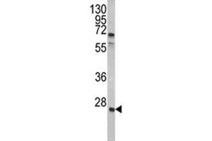 Western blot analysis of GRB2 antibody and A2058 lysate. (GRB2 抗体  (AA 89-118))