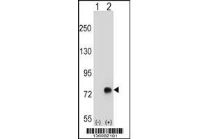 Western Blotting (WB) image for anti-Transforming Growth Factor, beta-Induced, 68kDa (TGFBI) (AA 106-135), (N-Term) antibody (ABIN5532297)