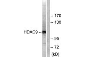 Western blot analysis of extracts from HepG2 cells, using HDAC9 Antibody. (HDAC9 抗体  (AA 1017-1066))
