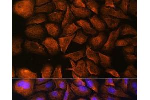 Immunofluorescence analysis of U-2 OS cells using SPTAN1 Polyclonal Antibody at dilution of 1:100. (SPTAN1 抗体)