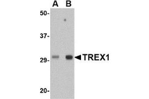 Western blot analysis of TREX1 in human spleen tissue lysate with this product at (A) 0. (TREX1 抗体  (Center))
