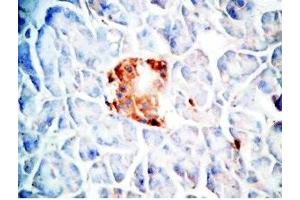 Human pancreas cancer tissue was stained by Rabbit Anti-Oxyntomodulin (H,M,R) Antibody (OXM 抗体)