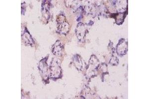 Immunohistochemistry of paraffin-embedded human placenta tissue using ABIN7176944 at dilution of 1:20 (Angiopoietin 2 抗体  (AA 19-483))