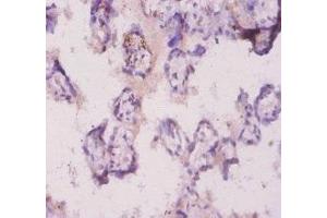 Immunohistochemistry of paraffin-embedded human placenta tissue using ABIN7176944 at dilution of 1:20