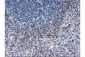 Immunohistochemical staining of paraffin-embedded Human tonsil using anti-ALG2 mouse monoclonal antibody. (ALG2 抗体)