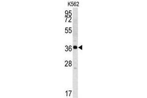 Western blot analysis of Kallikrein 2 (KLK2) Antibody (C-term) in K562 cell line lysates (35ug/lane). (Kallikrein 2 抗体  (C-Term))