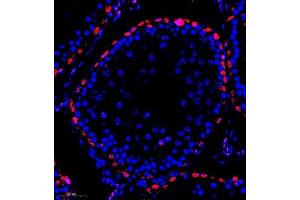 Immunofluorescence of paraffin embedded rat testis using MED17 (ABIN7074579) at dilution of 1:600 (300x lens) (MED17 抗体)