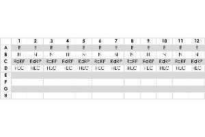 Example pipetting scheme for the distribution of mastermixes with the individual assay mixes. (PhoenixDx® 2019-nCoV RNA Detection Kit)