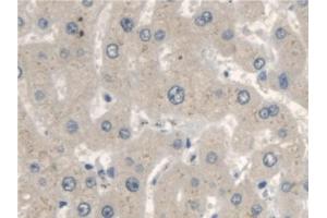 Detection of OXCT1 in Human Liver Tissue using Polyclonal Antibody to 3-Oxoacid Coenzyme A Transferase 1 (OXCT1) (OXCT1 抗体  (AA 40-489))