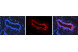 Rabbit Anti-NOTCH1 Antibody   Formalin Fixed Paraffin Embedded Tissue: Human Lung Tissue Observed Staining: Plasma membrane Primary Antibody Concentration: 1:100 Other Working Concentrations: 1:600 Secondary Antibody: Donkey anti-Rabbit-Cy3 Secondary Antibody Concentration: 1:200 Magnification: 20X Exposure Time: 0.