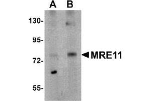 Western blot analysis of MRE11 in rat lung tissue lysate with MRE11 Antibody  at (A) 1 and (B) 2 μg/ml.