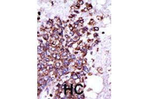 Immunohistochemistry (IHC) image for anti-Calcium/calmodulin-Dependent Protein Kinase I (CAMK1) antibody (ABIN3003045) (CAMK1 抗体)