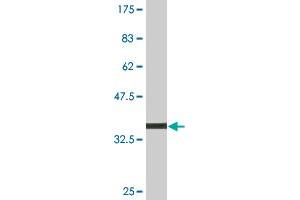 Western Blot detection against Immunogen (35. (MDH1 抗体  (AA 101-193))