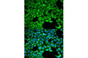 Immunofluorescence (IF) image for anti-Solute Carrier Family 3 Member 1 (SLC3A1) antibody (ABIN1876686) (SLC3A1 抗体)