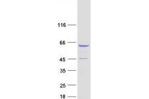 Western Blotting (WB) image for Coronin, Actin Binding Protein, 2A (CORO2A) (Transcript Variant 1) protein (Myc-DYKDDDDK Tag) (ABIN2712515)