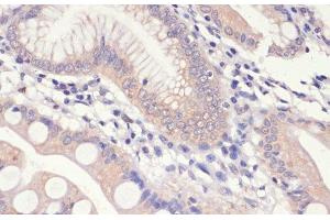 Immunohistochemistry of paraffin-embedded Human small intestine using HMGCR Polyclonal Antibody at dilution of 1:200 (40x lens). (HMGCR 抗体)