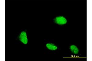 Immunofluorescence of monoclonal antibody to CSRP1 on HeLa cell. (CSRP1 抗体  (AA 94-192))